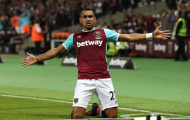 Chiếc áo West Ham quá nhỏ bé so với Dimitri Payet?