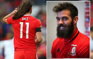 Tóc tai luộm thuộm, Bale bị đồng đội gọi là Tarzan