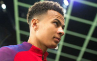 Dele Alli: Kane chưa phải là cầu thủ xuất sắc nhất Tottenham