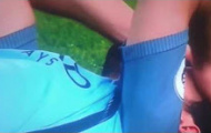 Cận cảnh chấn thương của Ilkay Gundogan 