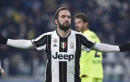 Gonzalo Higuain - Ngôi sao bị thế giới quay lưng