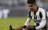 Paulo Dybala - Niềm hy vọng của Juventus trước Porto