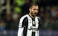 Chiellini: 'Không cần chơi đẹp, nhưng phải thông minh'
