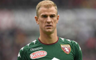 Joe Hart nhận thêm tin buồn từ Juergen Klopp