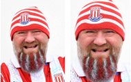 CĐV Stoke độ râu khủng để chào đón Chelsea 