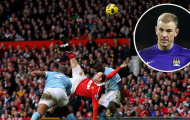 Những lần Joe Hart làm nền cho siêu phẩm