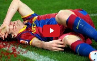 Những lần bị phạm lỗi kinh hoàng của Lionel Messi