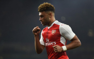 Lý do Alex Oxlade-Chamberlain liên tục được săn đón