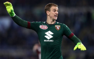 Chủ tịch Torino ngán ngẩm Joe Hart