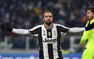 Sốc: Higuain viêm màng não, suýt chấm dứt với bóng đá