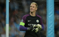 Man City lỗ nặng trong vụ Joe Hart