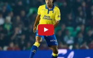 Tài năng đặc biệt của Mauricio Lemos (Las Palmas)