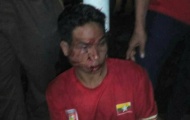 Tới Shah Alam coi đá bóng, CĐV U22 Myanmar bị đánh cho sấp mặt