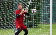 Fan Liverpool sửng sốt, khi Mignolet bị loại khỏi trận đấu với Arsenal