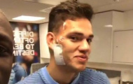 Ederson tự tin khoe thẹo sau cú vào bóng của Mane