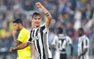 Nani, cựu sao MU đang chuẩn bị ra mắt Serie A