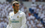 Gareth Bale thừa nhận phải dùng thuốc giảm đau để thi đấu 