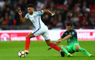 Alex Oxlade-Chamberlain chơi tệ thế nào trước Slovenia?