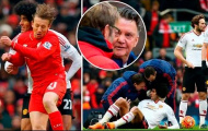 Mặt trái xấu xí của derby nước Anh
