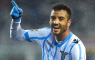 Đây vẫn chưa phải là Lazio phiên bản mạnh nhất