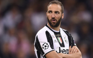 Gonzalo Higuain và nụ cười Mona Lisa