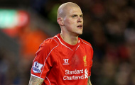 Liverpool cần một chiến binh như Skrtel