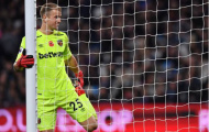 Muôn vàn sắc thái của Joe Hart khi bị Liverpool hủy diệt