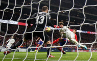 Cận cảnh Sergio Ramos bị đá vỡ mũi, máu tuôn đầm đìa