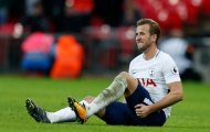 Lại thêm một người 'xát muối' vào nỗi đau của Tottenham