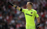 Joe Hart và những lần làm nền bất đắc dĩ