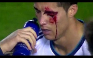 Không phải lúc nào niềm vui cũng hiện diện ở Cristiano Ronaldo