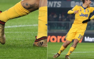 Dybala thăng hoa vì thoát kiếp giày đen?