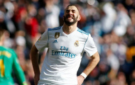 Real Madrid: Benzema chấn thương, Zidane... nhẹ đầu