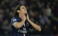Tuyển tập những khoảnh khắc 'chân gỗ' của Edinson Cavani