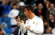 Cực hài: Ronaldo mượn điện thoại bác sĩ soi vết thương