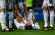 Để lập cú đúp, Ronaldo phải trả giá cực đắt