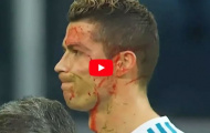 Những lần bị phạm lỗi thô bạo của Cristiano Ronaldo