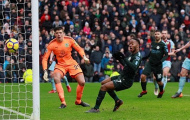 5 điểm nhấn Burnley 1-1 Man City: Cái giá của sự chủ quan