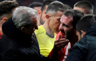 Đối phương giật cùi chỏ, sao Atletico Madrid gãy 3 răng cửa