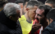 Godin phải trồng lại răng sau chiến thắng của Atletico