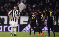 5 điểm nhấn Juventus 2-2 Tottenham: Higuain lắm công, nhiều tội
