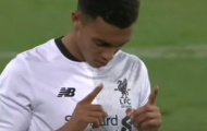 Trent Alexander-Arnold, sao mai tiến bộ nhất của Liverpool mùa này