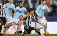 Góc Juventus: Đẳng cấp chấp hết tất cả