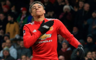 03h00 ngày 06/03, Crystal Palace vs Man Utd: Vượt bão chấn thương