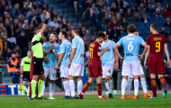Bàn thắng thì không, nhưng thẻ đỏ lại xuất hiện tại Derby thành Rome