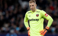 'Joe Hart nên ngồi nhà xem World Cup'