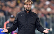 Liverpool sẽ thi đấu như Manchester United?