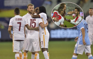 AS Roma và bài học từ Monaco