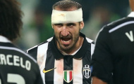 Giorgio Chiellini: Vị thủ lĩnh không thể chối cãi của Juve