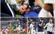 Lãnh trọn cú đấm của thủ thành tuyển Mỹ, Oliver Giroud đổ máu, gục xuống sân